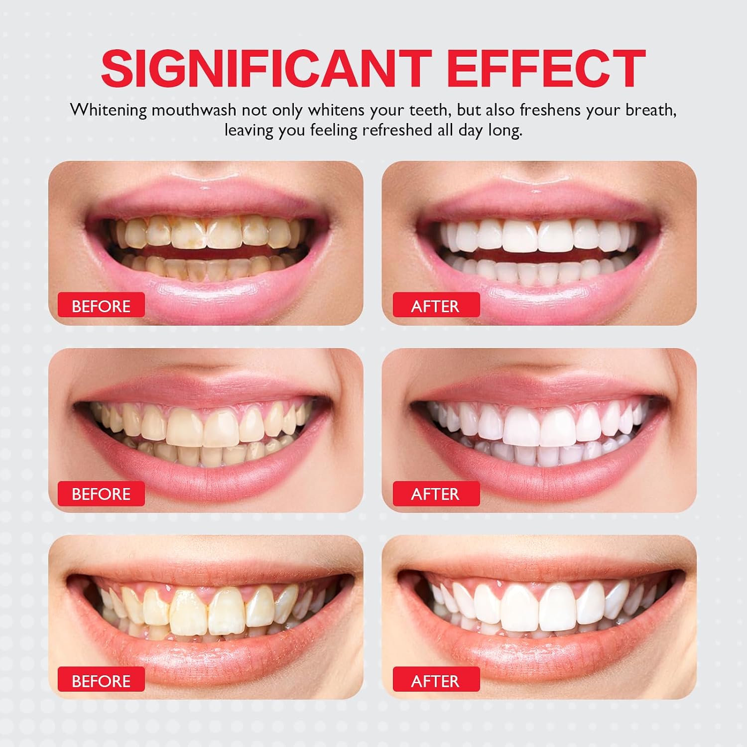 Stain Whitening and Gunk Removing Mouthwash for cleaner teeth